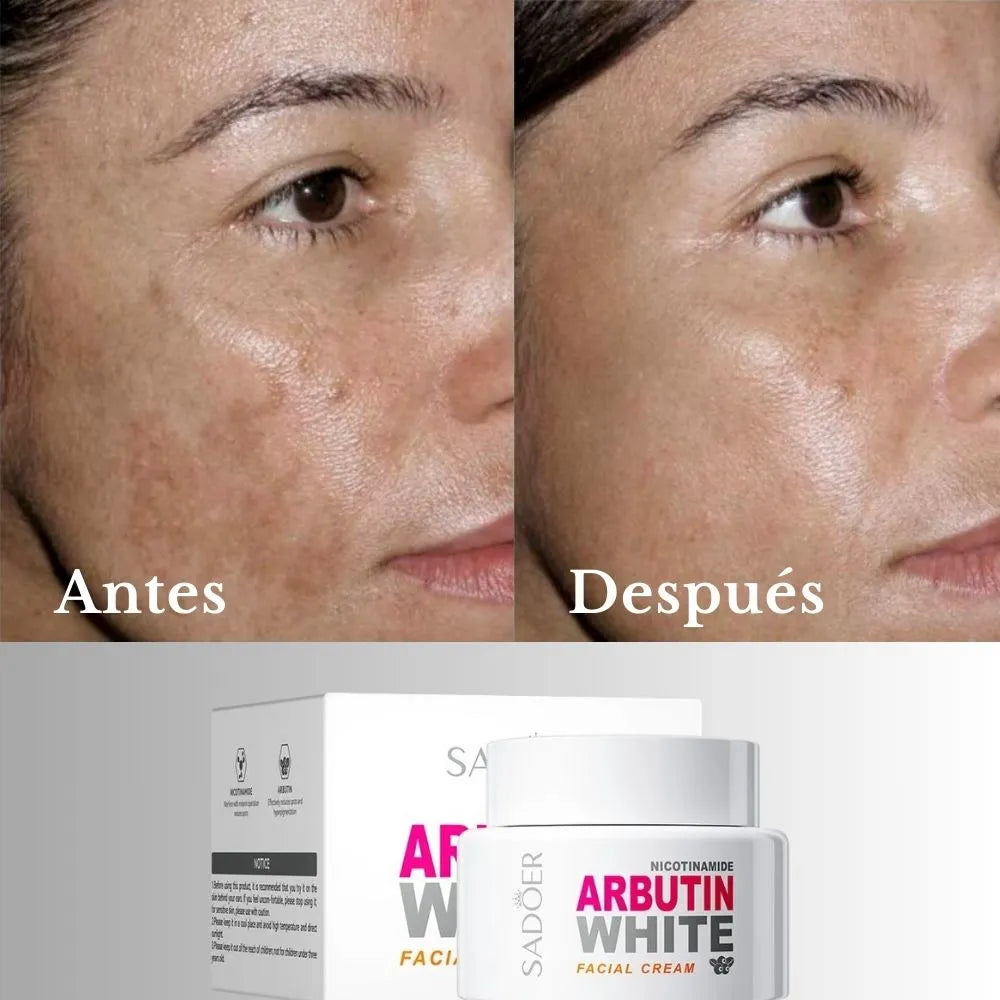 COMBO 2 CREMA ACLARANTE ARBUTIN WHITE