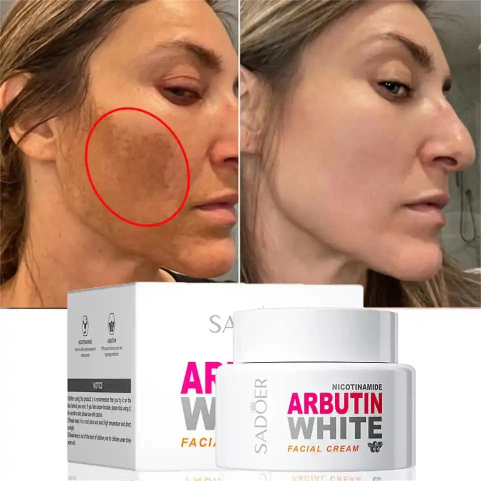 COMBO 2 CREMA ACLARANTE ARBUTIN WHITE
