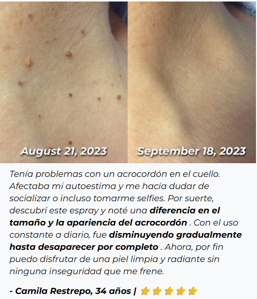 ADIÓS VERRUGAS - Eliminador de Verrugas y Manchas - TAG RECEDE